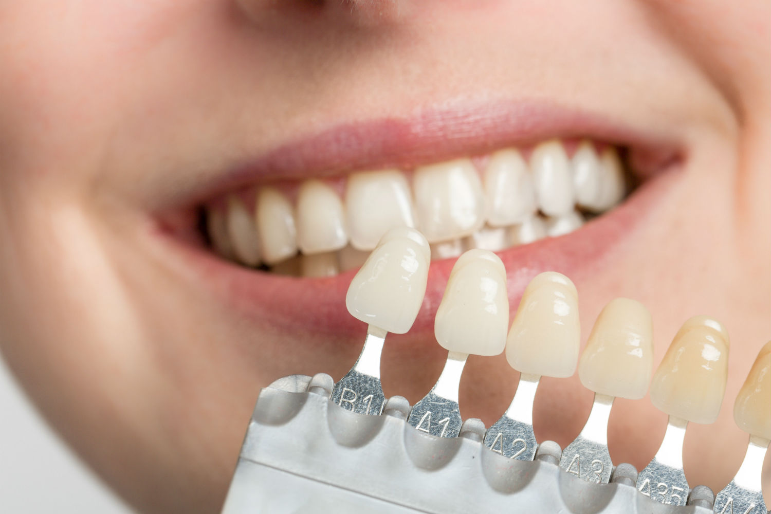 Facts You Need To Have Account Of About Oral Health